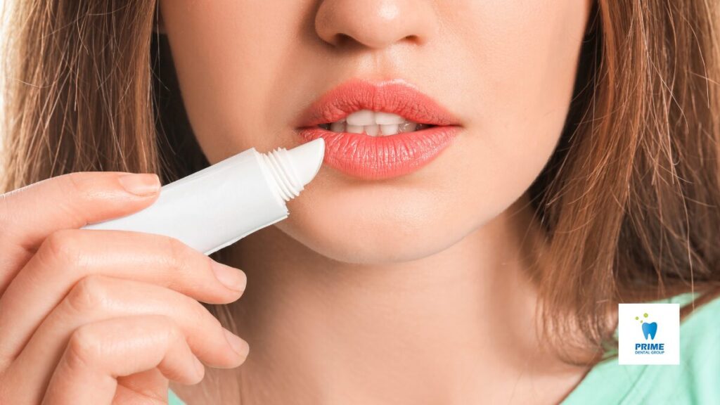 Woman applying lip balm to protect against winter chapped lips.