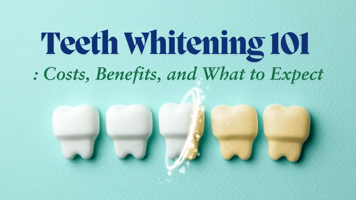 Illustration of teeth transitioning from yellow to white, symbolizing the benefits of professional teeth whitening treatments.