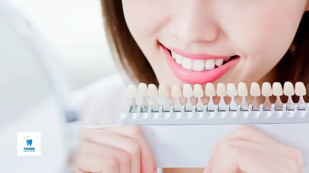 A smiling woman holding a tooth shade guide to compare shades of white teeth, showing options for teeth whitening.