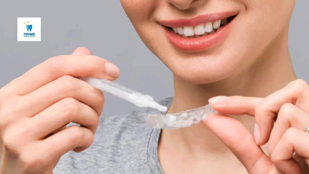 A smiling woman applying whitening gel to a custom dental tray, preparing for at-home teeth whitening treatment.