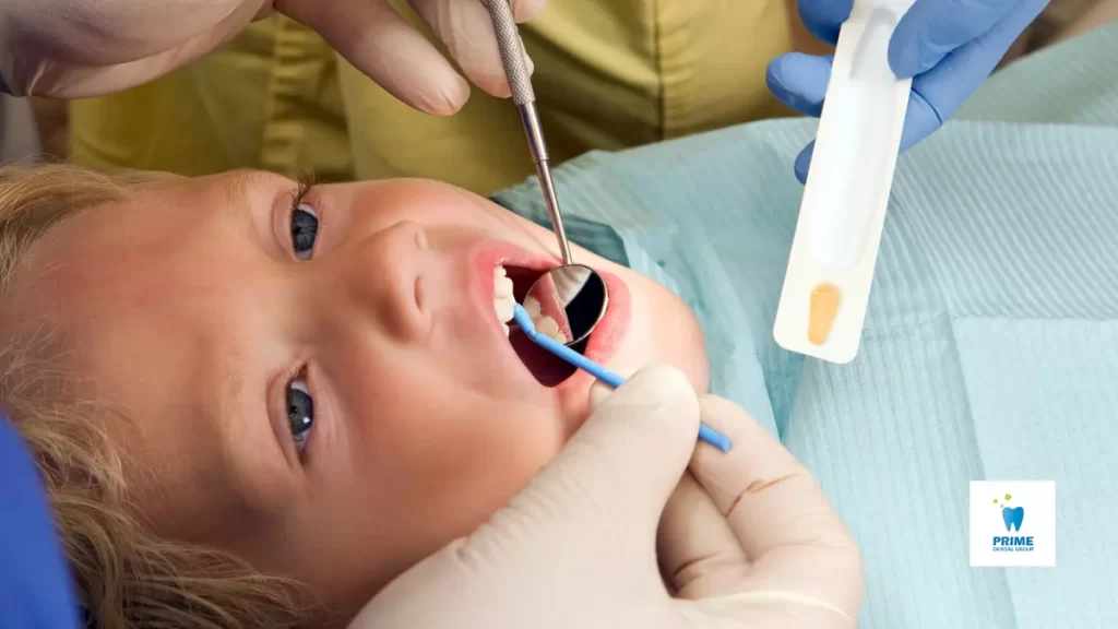 A young child receiving a professional fluoride treatment at a dental clinic to strengthen enamel and prevent cavities.